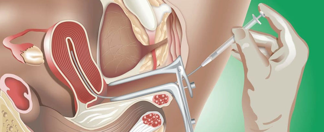 Gynecologist in East Delhi | Gynecologist in Shalimar Bagh  | IVF SPECIALIST IN EAST DELHI.